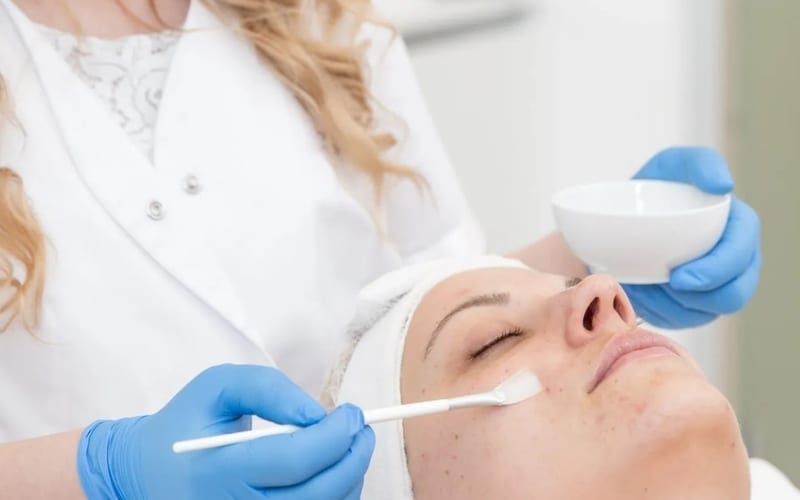 Skin Resurfacing & Chemical Peels